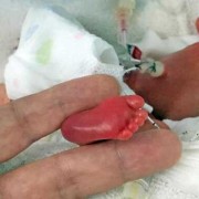 15天宝宝身长多少,88天胎儿稳定了吗
