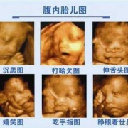 孕期做四维（孕期做四维的最佳时间）