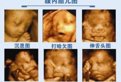 孕期做四维（孕期做四维的最佳时间）