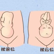 怎么自我判断胎儿是不是横位,b超胎儿横位什么意思