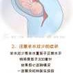 羊水少是胎儿有问题吗（羊水少是什么原因导致的）