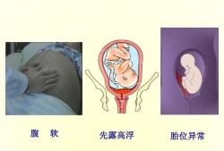 浮胎是什么意思,胎儿顶先露是啥意思