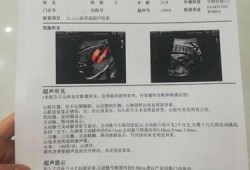 胎儿心脏彩超做多久（胎儿心脏彩超做多久时间）