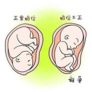 葡萄胎儿（兔子摸胎具体摸哪个位置）