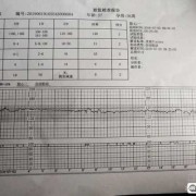 胎儿监护仪价格（胎心监护多少分正常）