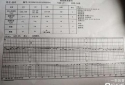 胎儿监护仪价格（胎心监护多少分正常）