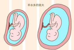 孕妇羊水多对胎儿有没有影响（羊水过多胎儿畸形风险多大）