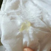 孕妇白带发绿对胎儿有影响吗（怀孕后一坨坨黄绿色分泌物）