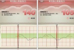宝宝什么时候有胎心,多久可以听见胎儿心跳声