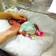 32周胎儿多重（32周胎儿多重才正常）