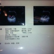 怀孕26周了应该去医院做什么检查啊,第26周胎儿发育情况如何