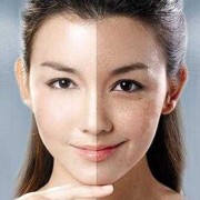 孕期防止长斑（为什么脸上有斑要防晒）