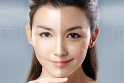 孕期防止长斑（为什么脸上有斑要防晒）