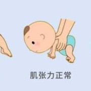 胎儿的脑瘫是怎样形成的,胎儿脑瘫是怎么形成的原因