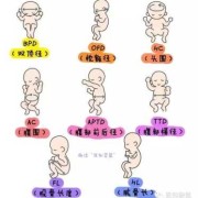 胎儿股骨长图片（胎儿股骨长图片示意图）