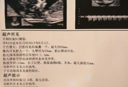 12周胎儿nt（12周胎儿nt值正常范围）