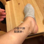 孕期腿脚浮肿（孕妇脚水肿怎么办）