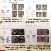 孕妇外阴红肿，发痒怎么办,