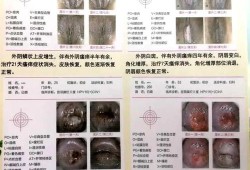 孕妇外阴红肿，发痒怎么办,
