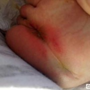 胎儿屁股朝下（胎儿屁股朝下有什么说法）