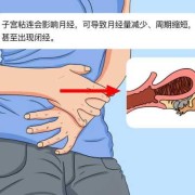 粘连带对胎儿有影响吗（子宫粘连带对胎儿有影响吗）
