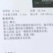 怀孕天数怎么算的？B超可以检测出，怀孕的天数吗,胎儿周期计算表