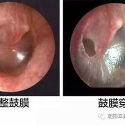 宝宝耳膜破了的症状是什么,胎儿耳膜会被震聋吗?