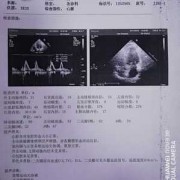 做胎儿心脏彩超要多少钱（做胎儿心脏彩超要多少钱一次）