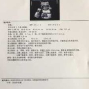 胎儿胆囊大小（提示胎儿胆囊显示不清,这说明什么情况）