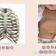 胎儿肋骨（胎儿肋骨）