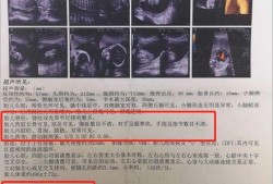 四维B超单上写着胎儿生物物理相评分8分是什么意思,胎儿八个月四维彩超图片
