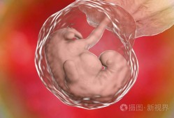 四周胎儿图（胎儿偏小四周怎么办）