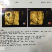 23周男女胎儿区别图（23周的三维宝宝的数据都在正常指标吗?需要注意什么）
