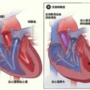 胎儿肺动脉狭窄原因（胎儿肺动脉狭窄原因有哪些）