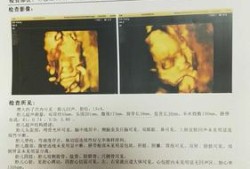 胎儿一直偏小一周（胎儿一直偏小一周）