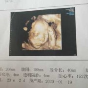 孕期四维检查最佳时间（四维多久做是最佳时间）