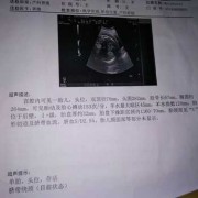 医生说胎儿腿长（医生说胎儿腿长是暗示男女吗）