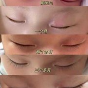 孕期种睫毛（孕期种睫毛对胎儿有影响吗）