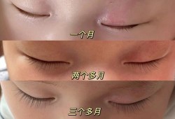 孕期种睫毛（孕期种睫毛对胎儿有影响吗）