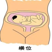 横位胎儿妈妈要注意什么（孕27周胎儿横位怎么办呢，这样的情况平时可以做操改善的吗）