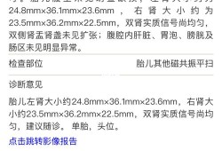胎儿肾脏偏大问题大吗（胎儿肾脏偏大问题大吗）