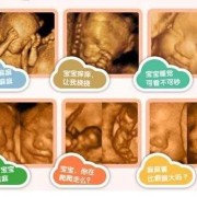 做四维彩超对胎儿有影响吗（做四维彩超对胎儿有影响吗）