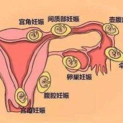孕期有褐色分泌物怎么回事,孕早期有褐色分泌物是怎么回事