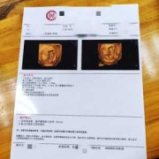 孕妇二维彩超检查什么啊？不知道一般情况下检查哪些方面,孕期彩超做的频繁对胎儿有影响吗