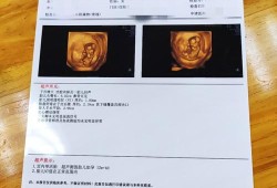 孕妇二维彩超检查什么啊？不知道一般情况下检查哪些方面,孕期彩超做的频繁对胎儿有影响吗