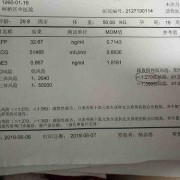 胎儿21三体临界风险（唐氏筛查21三体检查临界高风险要怎么办）