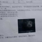 宫腔内囊性回声什么意思,胎儿右下腹囊性回声严重吗