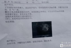 宫腔内囊性回声什么意思,胎儿右下腹囊性回声严重吗