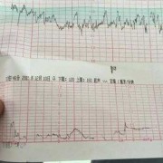 孕妇做胎心监护时，宝宝心率很高是怎么回事,孕晚期胎儿心率快是怎么回事