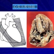 四腔心是什么,胎儿心脏单心室单心房孩子能要吗